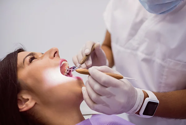 Fillings