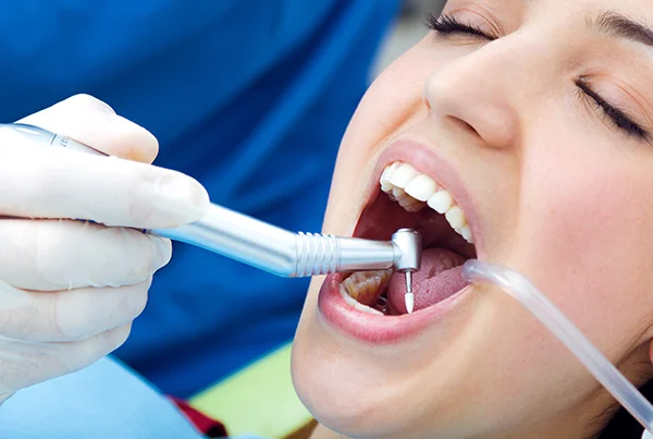 Dental Implant